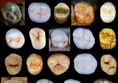 hominin teeth evolution neanderthal modern human divergence fossil record